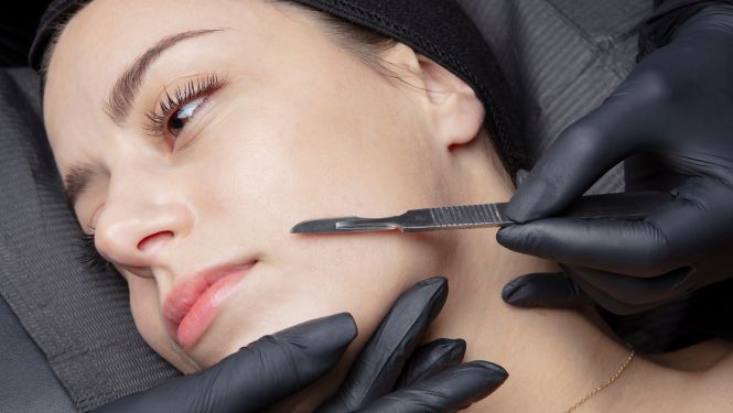 Warner Robins Dermaplaning
